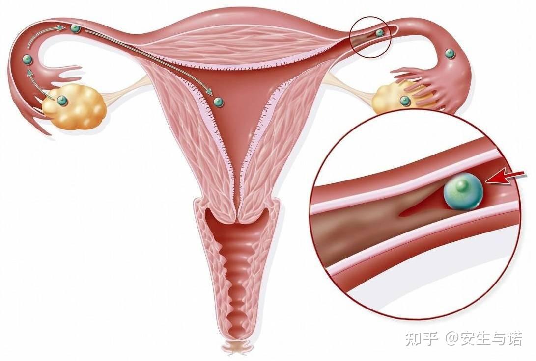 25岁女孩婚前体检意外发现无子宫，探寻身体与心理的双重挑战