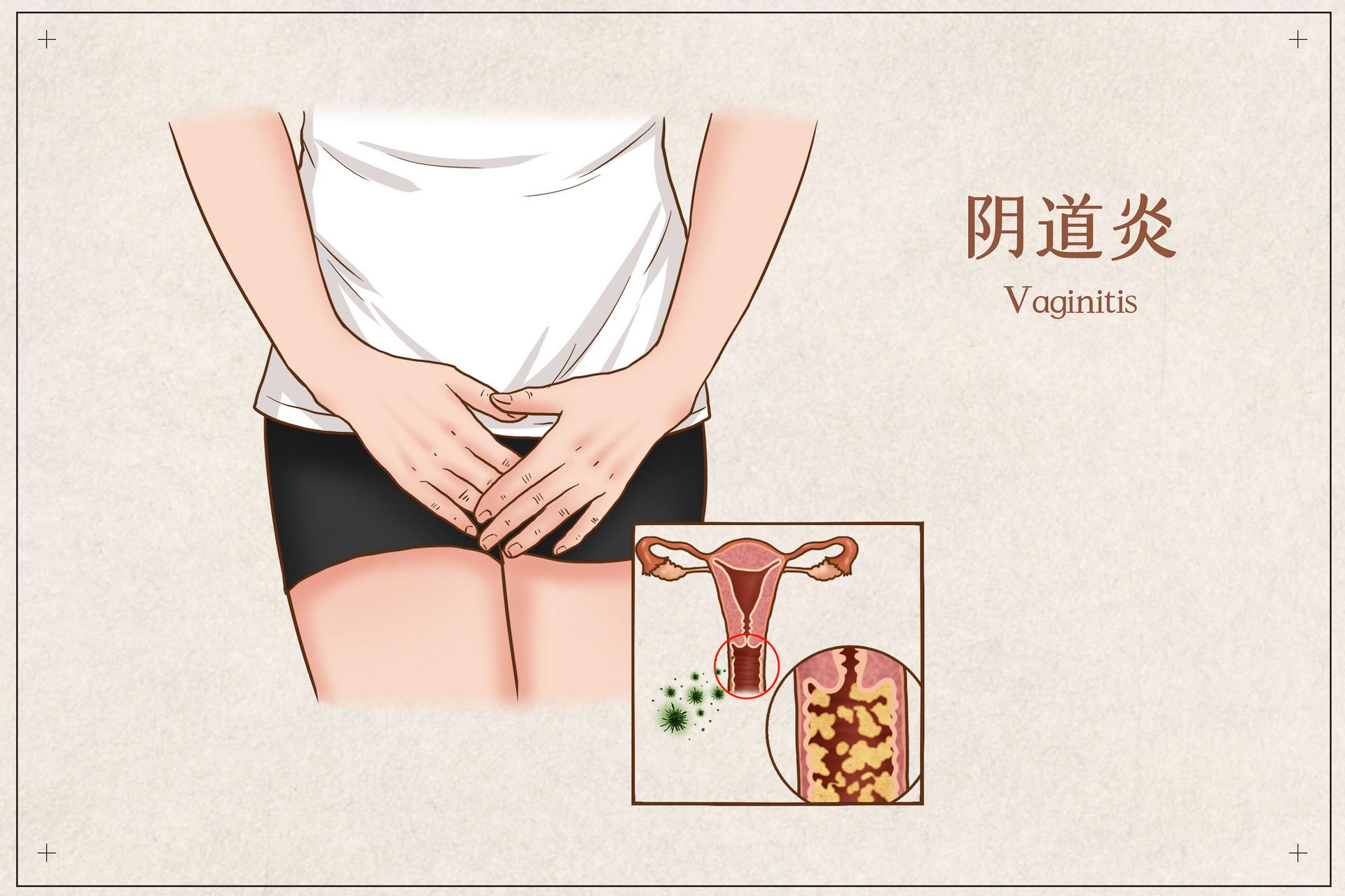 卵巢早衰想要孩子怎么办？全面解析应对策略