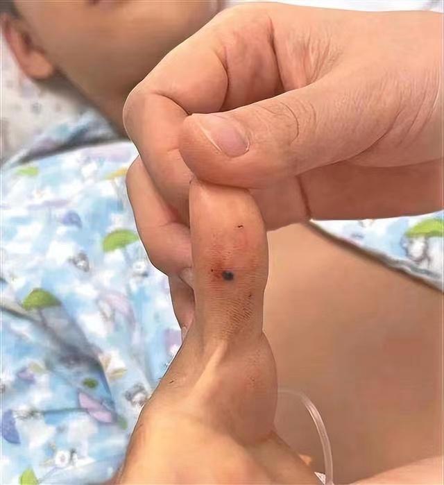 女游客在三亚被蛇咬伤就医后身亡事件分析