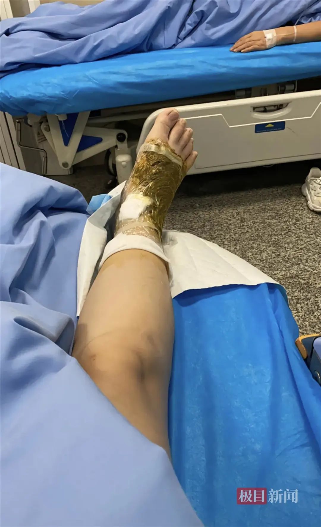 女游客在三亚被蛇咬伤就医后身亡事件分析