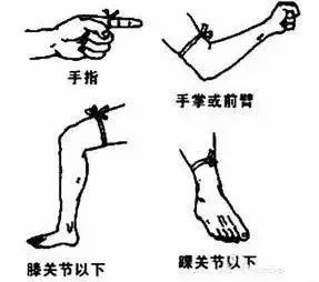 毒蛇咬伤自救指南，关键步骤与注意事项