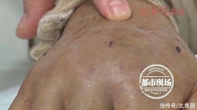 女子疑被蛇咬身亡，事件深度解析与回应预计