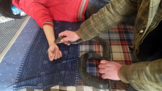 男子割草遭遇眼镜蛇咬伤手指，险些截肢——生死边缘的挑战与重生