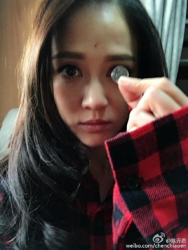 陈乔恩满脸扎针晒保养方法引热议