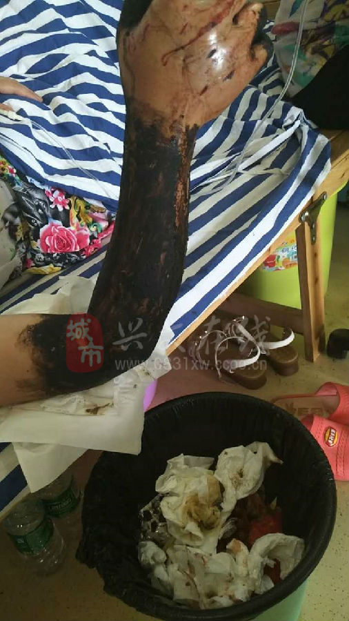 揭秘武夷山假闻，一女游客被蛇咬死真相